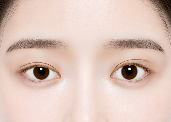 Incisional-Eye-Asymmetry-Correction-step1