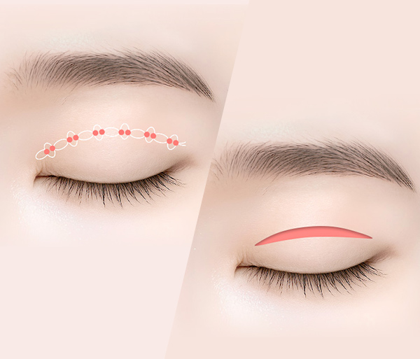 multiple-crease-correction-spe6