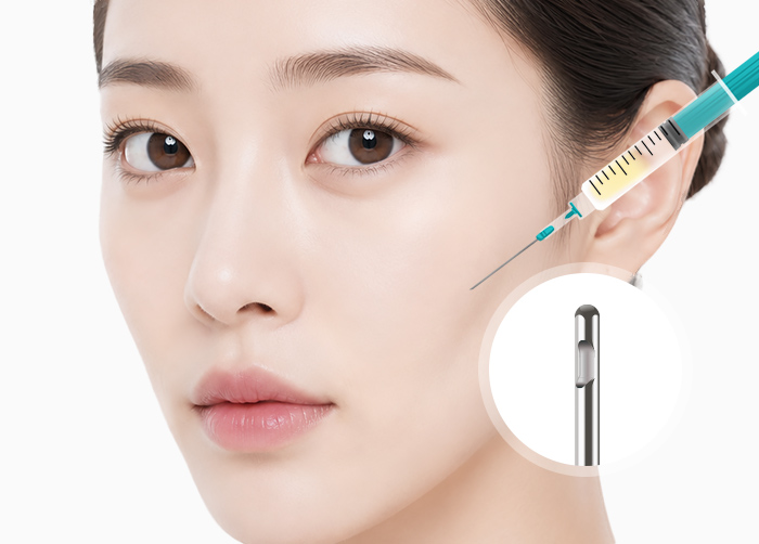 지방이식 수술방법