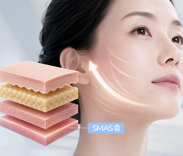 smas-facelift-spe1